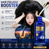 Hair Growth Serum Anti Hair Loss Treatment Follicle Activator Density Booster Scalp Root Care Oil Thinning Hair Men Women 50ml