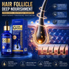 Hair Growth Serum Anti Hair Loss Treatment Follicle Activator Density Booster Scalp Root Care Oil Thinning Hair Men Women 50ml